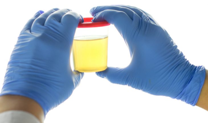 Synthetic Urine